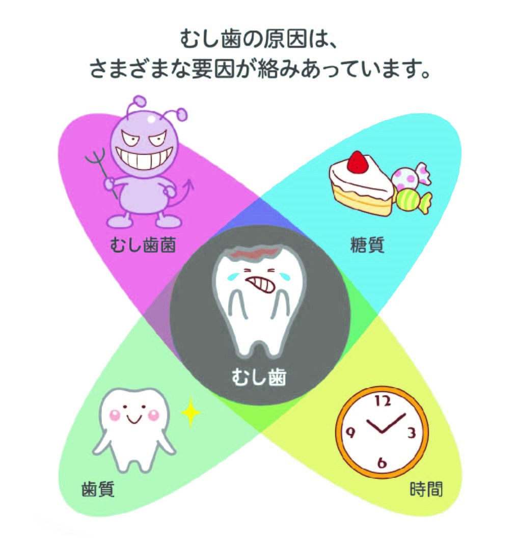 歯科保健関係者向け】むし歯予防・管理の最前線－削らずに歯を護り管理